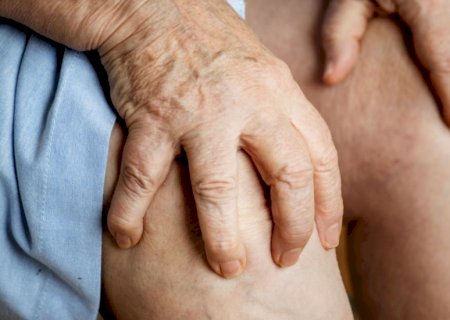 Silenciosa, lipedema é doença que desafia diagnóstico e impacta autoestima