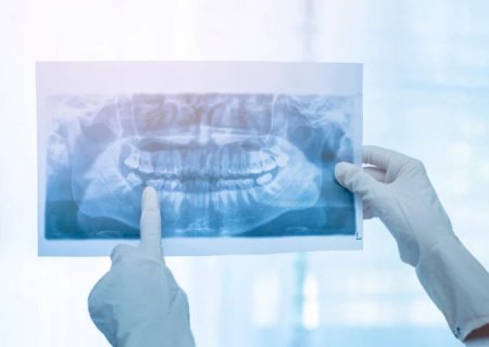 SES auxilia na compra de raio-X panorâmico para equipar municípios com estrutura odontológica avançada