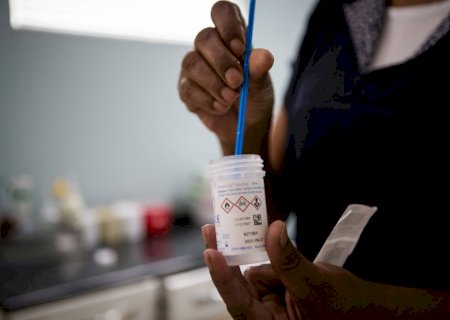 SUS começa a substituir papanicolau por teste de DNA a partir de maio