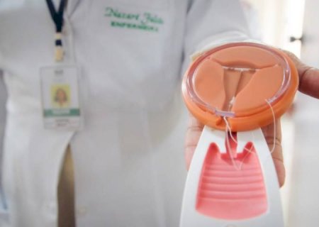 Mais acesso, mais autonomia: Governo fortalece distribuição gratuita de contraceptivos de longa duração em MS