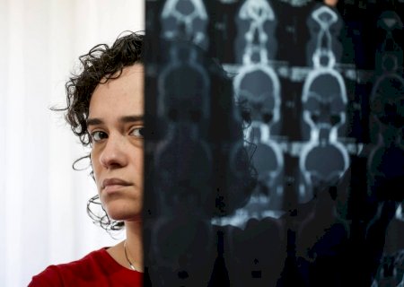 Entenda o que é a síndrome da fadiga crônica, doença que causa cansaço extremo