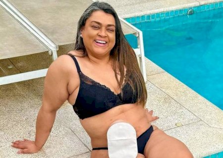 Após morte de Preta Gil, aumenta procura por exame de colonoscopia