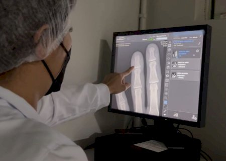 Governo entrega ultrassom e raio-x de alta resolução que ampliam precisão em mais de 600 exames por mês
