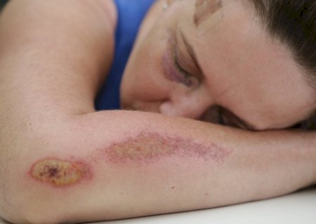 Nos primeiros dez dias do ano, quase 500 mulheres sofreram violência doméstica