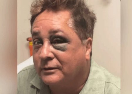 Leonardo sofre queda no Pantanal e esposa atualiza estado de saúde do cantor