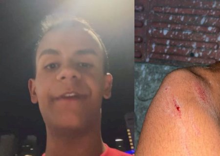 Jovem denuncia ataque com pitbull motivado por homofobia: ‘Vou processar’