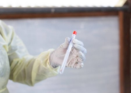 Cientista que desenvolveu vacina contra Covid é acusado de tentar contrabandear vírus de mpox