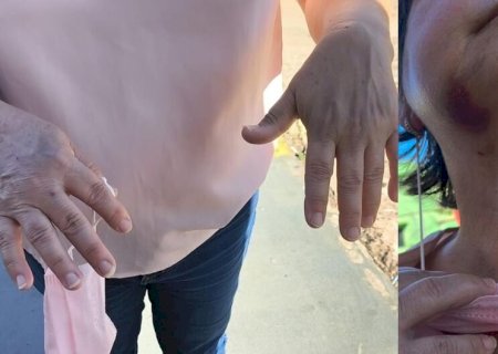 Idosa denuncia vizinho por estupro e agressão dentro de casa em Campo Grande