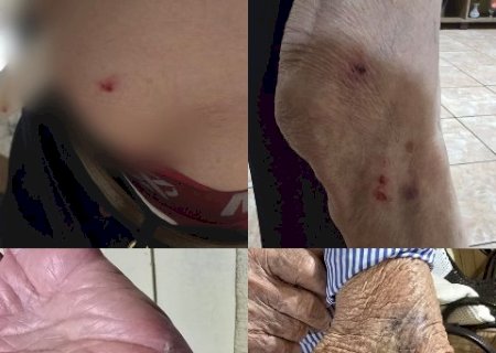 Cachorro derruba e morde idoso de 87 anos a caminho do mercado