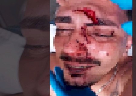 Jovem é atingido por garrafada na cabeça durante a Fejuna e acaba hospitalizado em Nova Andradina