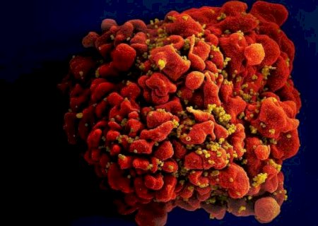 Nova vacina experimental contra o HIV mira partes do vírus que não mudam