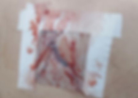 Homem é esfaqueado após desentendimento durante consumo de bebida alcoólica em Jarim-MS
