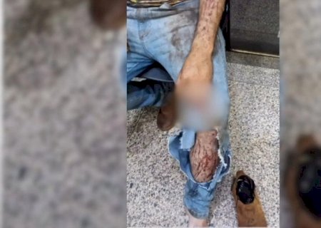Trabalhador é atacado por onça durante trabalho em lavoura em MS