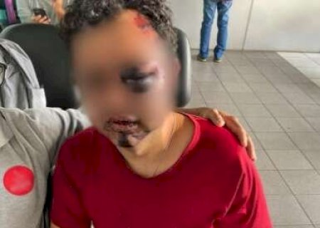 Trio usa “boa-noite, Cinderela”, espanca homem e rouba carro