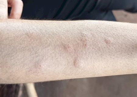 MPMS investiga possível relação entre usina de açúcar e álcool e infestação de moscas em Angélica