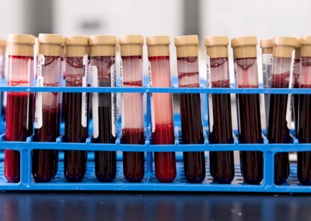 Exame de sangue que busca detectar mais de 50 tipos de câncer chega ao Brasil